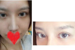 做完眼线能吃羊肉吗,羊肉是否适宜食用